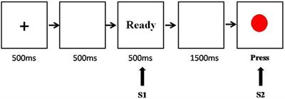 Impaired sustained attention in groups at high risk for antisocial personality disorder: A contingent negative variation and standardized low-resolution tomographic analysis study